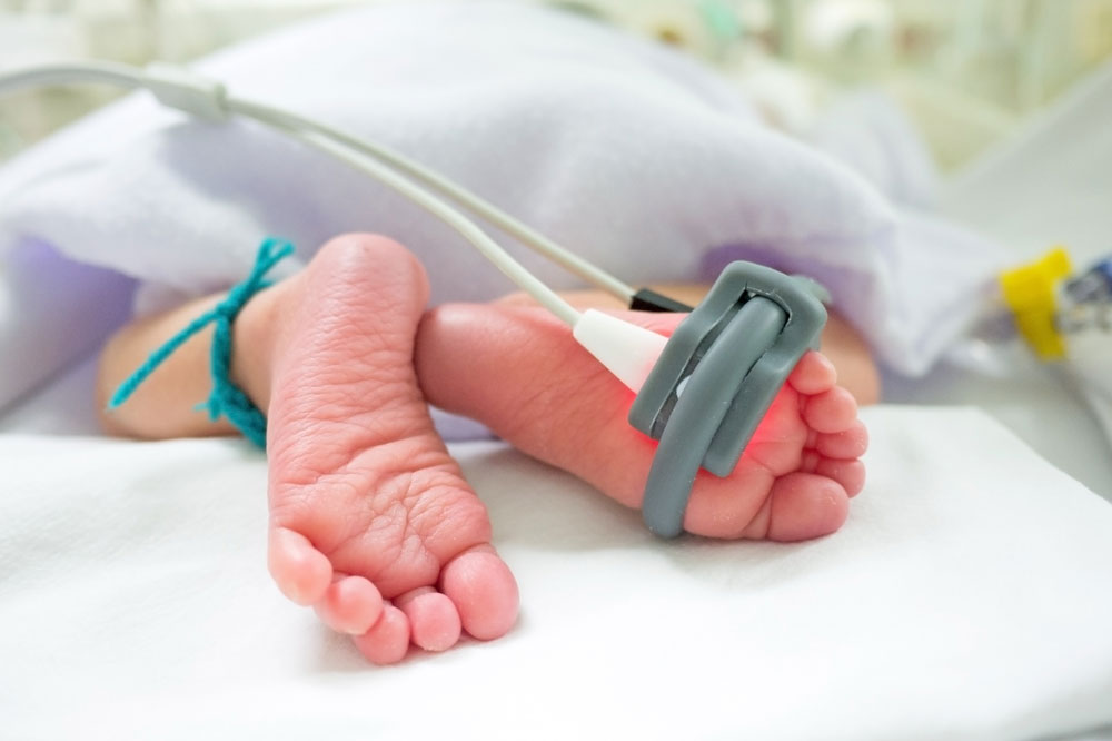 Neonatal baby feet with sensor clip attached to one foot
